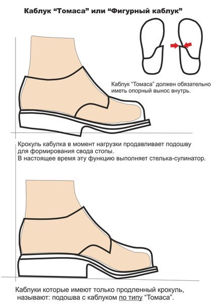 КАБЛУК ТОМАСА – решение детских ортопедических проблем